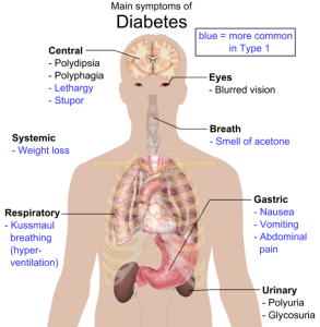 Main symptoms of diabetes